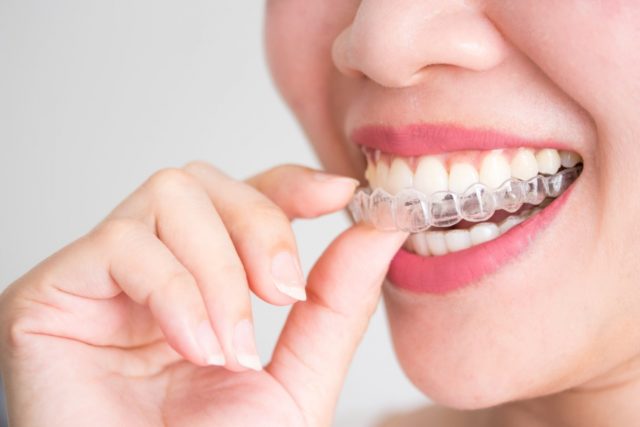 ¿Qué personas necesitan ortodoncia?