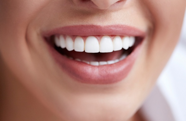Diseño sonrisa en guayaquil rehabilitación odontología estetica