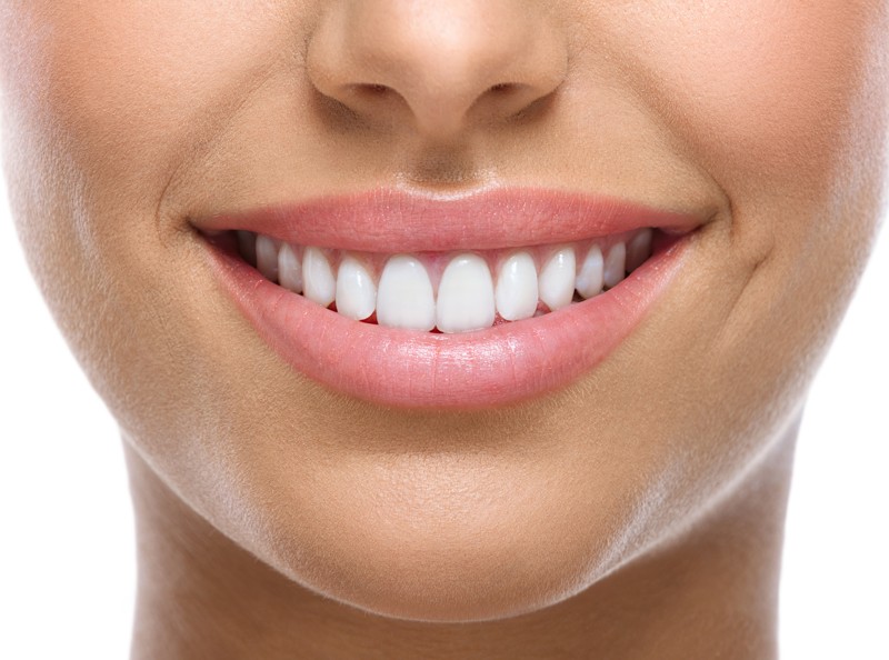 ¿Cómo puedo mejorar la forma de mis dientes para tener una sonrisa más atractiva?